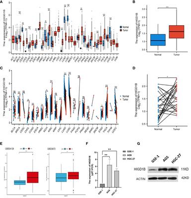 HIGD1B, as a novel prognostic biomarker, is involved in regulating the tumor microenvironment and immune cell infiltration; its overexpression leads to poor prognosis in gastric cancer patients
